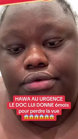 Hahaw risque de perdre la vue 😰😰😰 #hawaloulou #hawabelle28 #abonnetoi❤️❤️🙏 