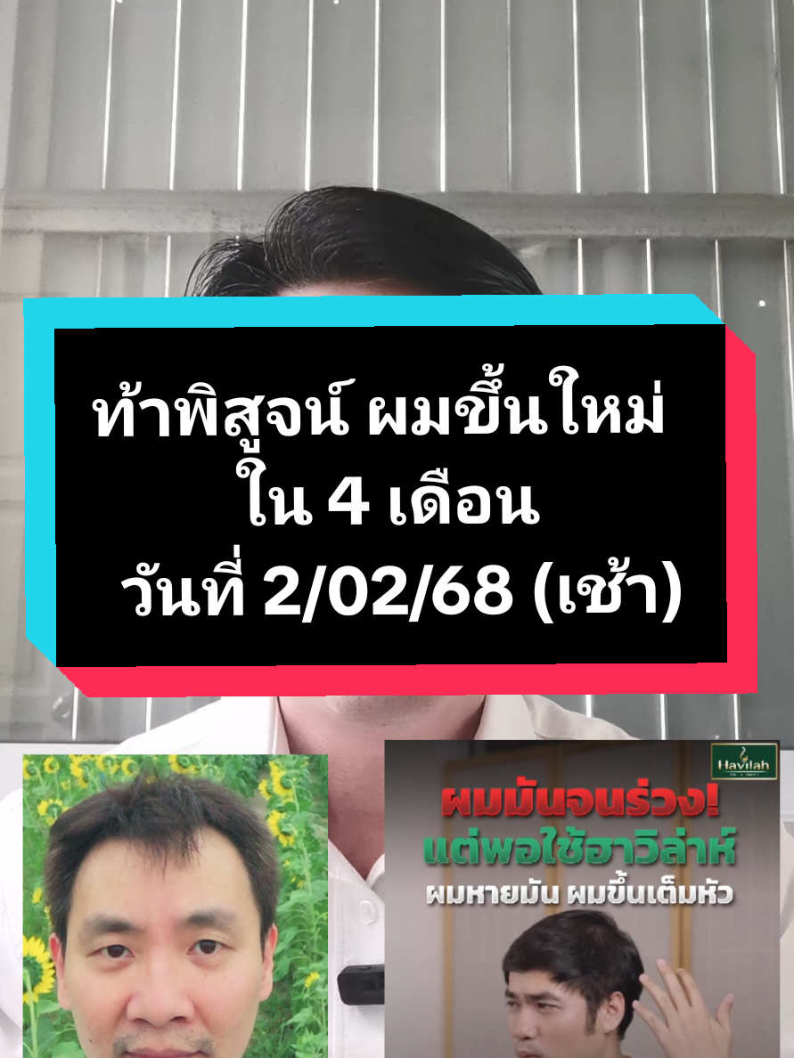 ปัญหาผมร่วง ผมบาง แก้ไขได้ด้วยฮาวิล่าห์แชมพูและแฮร์โทนิค ด้วยสถิติการรักษาได้ผลเป็นอันดับ 1 สิบปีซ้อน ผลิตภัณฑ์แนะนำ (ชุดที่เห็นผลมากที่สุด) 1. ฮาวิล่าห์แชมพู ขนาด 300 ml. ราคา 890 บ. (จากราคาปกติ 1,190 บ.) 2. ฮาวิล่าห์แฮร์โทนิค ขนาด 100 ml. ราคา 690 บ. (จากราคาปกติ 990 บ.) ผมร่วงน้อยลงชัดเจนตั้งแต่ชุดแรกที่ใช้ และผมเริ่มขึ้นใหม่ในเวลา 3-4 เดือน #แชมพูลดผมร่วง  #เซรั่มปลูกผม  #ลดผมร่วง  #ฮาวิล่าห์  #Havilah 