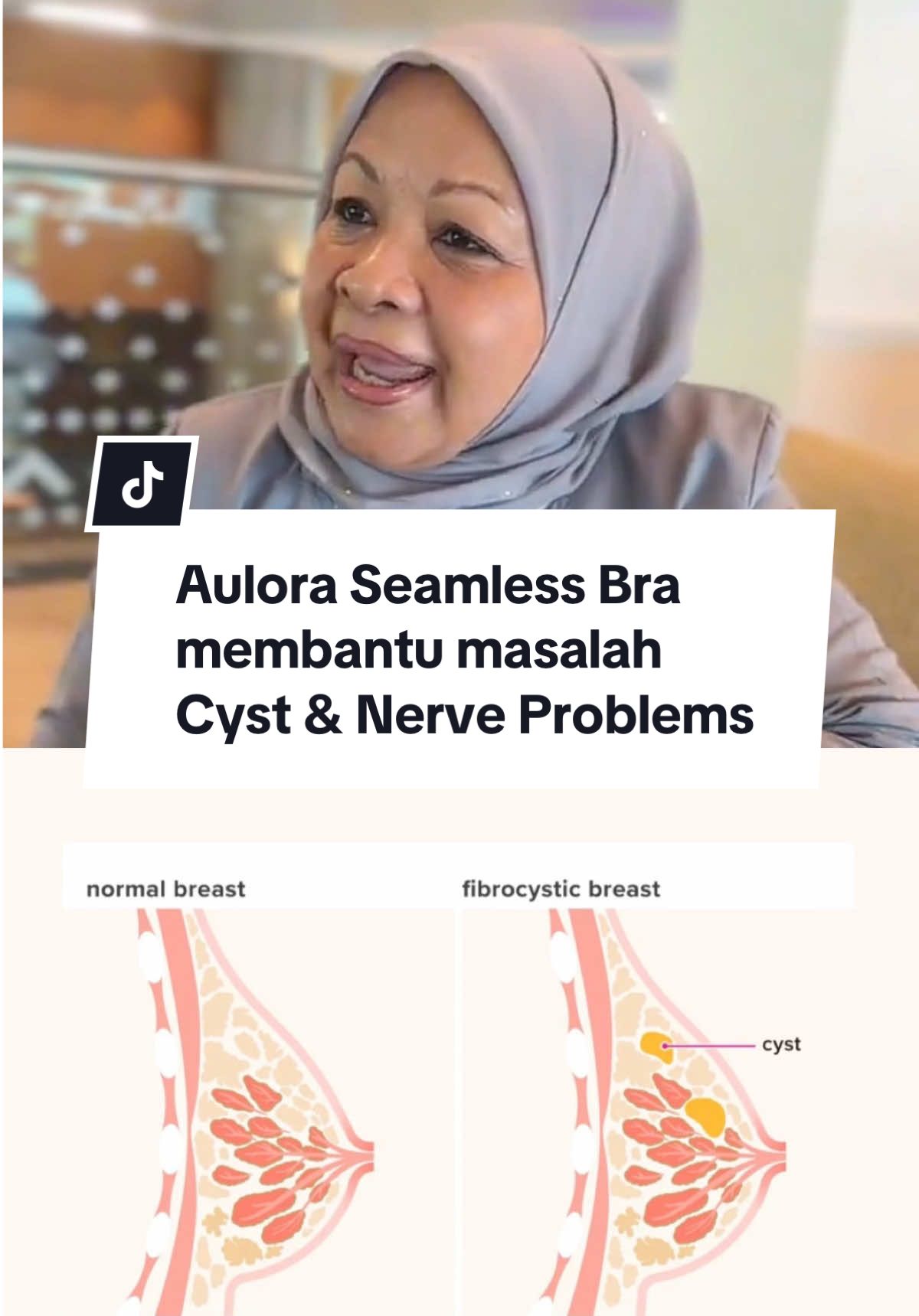Testimoni Mama Rozee selepas menggunakan Aulora Seamless Bra, masalah cyst pada breast hilang dah masalah saraf pulih sepenuhnya! Alhamdulillah! 🥰🤲🏻 WhatsApp saya, Anna  di 018-3580258! ✨ #AuloraSeries  #AuloraSeriesWithKodenshi  #AuloraPantswithKodenshi   #AuloraArmSleeves #auloraseamlessbra  #auloraseamlessbrakodenshi  #aulorapants  #zencosoball  #livcore  #shiruto  #befil  #masalahsaraf #cyst  #diabetes#triggerfinger  #frozenshoulder  #rahimbengkak #migrain  #sakiturat #sakitperut #cramp  #gerd  #acidreflux  #anginpasang  #anginahmar  #asthma #asma  #buasir #buasirberdarah  #tulangretak  #tulangpatah #scoliosis  #stroke  #slipdisc  #sciatica  #sakitlutut  #osteoarthritis  #patellofemoralpainsyndrome  #sakitumit  #sakitpinggang  #aulorasakitlutut #peranakanjatuh #mummytummy #perutkembung #ttccommunity #ttcjourney  #beinternational #beinternationalmalaysia  #creatorsearchinsights 