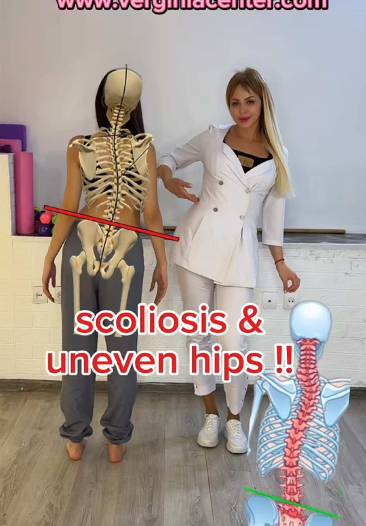 If you have uneven hips, try this exercise to improve your alignment and balance! ✅ Consistency is key to seeing results. for more exercises 🔗 www.verginiacenter.com #SpineHealth #UnevenHips #PostureCorrection #Scoliosis #Kyphosis #Lordosis #Physiotherapy #HealthyBack #PainRelief #Wellness #DrMarinaIspiryan #جنف #սկոլիոզ #scoliosisexercise #scoliosiswarrior #scoliosistreatment 