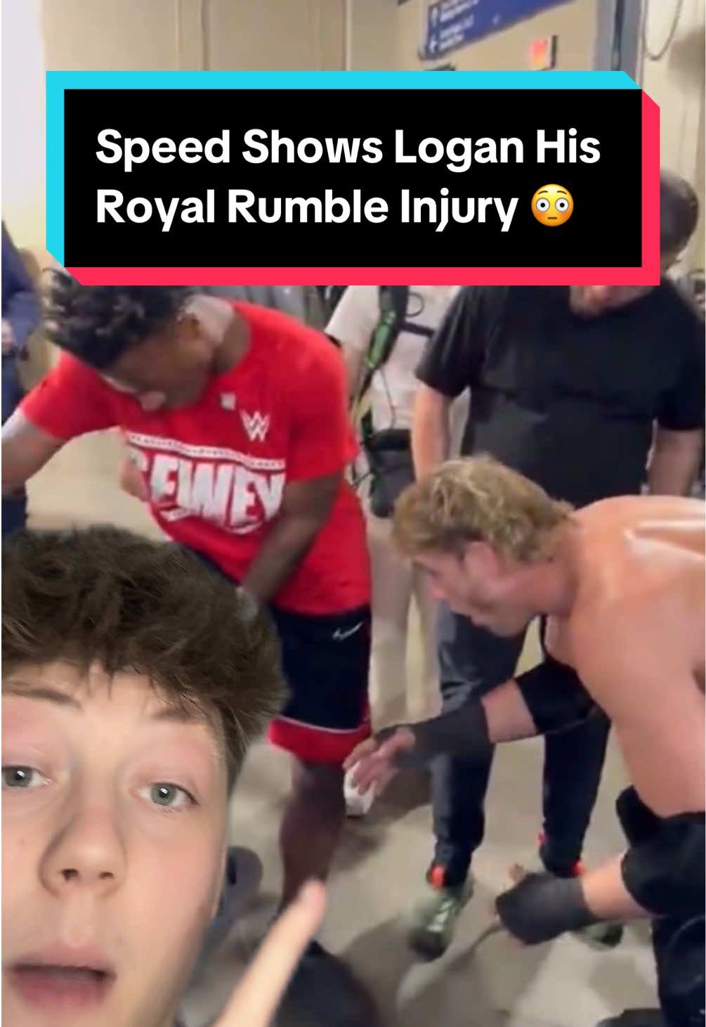 Speed Shows Logan His Royal Rumble Injury 😳 #ishowspeed #loganpaul #WWE #wwefan #wweraw #RoyalRumble #royalrumble2025 