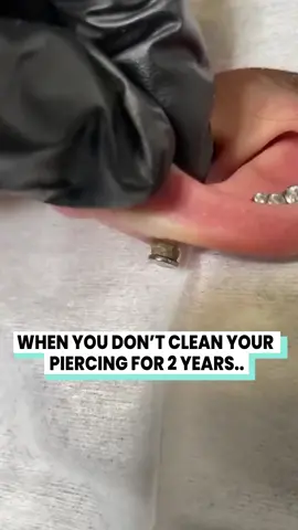 Make sure you are looking after your piercing's!! (@chernaja_karakatica ) #percings #aftercare #earrnings #shouldiget #piercingcaretips  when you don't clean your piercing for 2 years