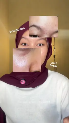 retinol buat pemula karna ga bikin cekat cekit tapi hasilnya mantep bgt buat kulit 🫶🏻 #retinolserum #serumretinol #mireyacosmetics #fyp 
