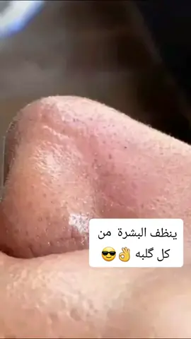جهاز تنظيف البشره و شفط الدهون #الاصلي 💯  يعمل الجهاز على تقشير الوجه بواسطة الرأس الماسي اضافة الى شفط دهون الوجه وازالة البثور والرؤوس السوداء يحتوي الجهاز على الرأس الماسي يستخدم للوجه والعنق كما ويحتوي على 3 رؤوس اخرى مختلفة الأحجام تستخدم لشفط وازالة الرؤوس السوداء وبقايا حبوب الشباب والزيوت من البشرة الدهنية  يحتوى على 4 رؤوس  🌸 الاول لتقشير الوجه 🌸 الثاني لتنضيف مسامات الوجة  🌸 الثالث راس لشفط الدهون من المناطق الصغيره مثل الانف وغيرها  🌸 الرابع بسحب الجلد الميت  ميسوي اي تحسس بالبشره ويحتوي على سرعات للشفط حسب الحاجة. ✅ ويستخدم ايضا لعلاج الحالات التالية  ✅ تلف البشرة الناتج عن التقدم في العمر ✅ الرؤوس السوداء ✅ التخلص من التجاعيد والندوب البسيطة  ✅ التخلص من اسمرار المناطق الحساسة ✅ يحفز انتاج الكولاجين في البشرة ✅ ازالة خلايا البشرة الميته #جهاز_شفط_الدهون #جهاز_الانف #جهاز_تنظيف_البشرة #ازالة_الرؤوس_السوداء #اكسبلورexplore #شهر_شعبان #متباركين_بمولد_الاقمار_الشعبانيه #fyp #viral #رائج_الأن 