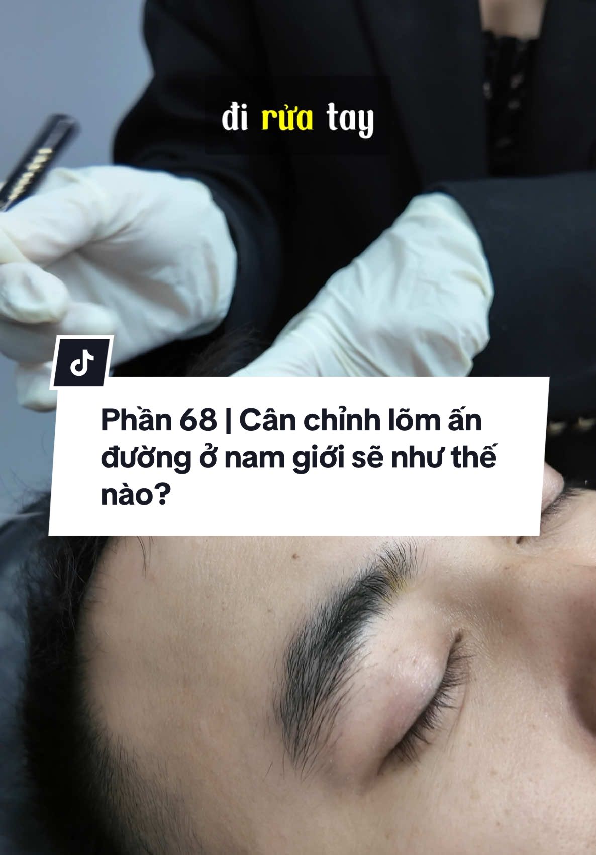 Phần 68 | Cân chỉnh lõm ấn đường ở nam giới sẽ như thế nào?😥 #novagroup #daotaothammy #filler #botox #fybシ #xuhuongtiktok #mellowlips #xuhuong #fillerbotox 