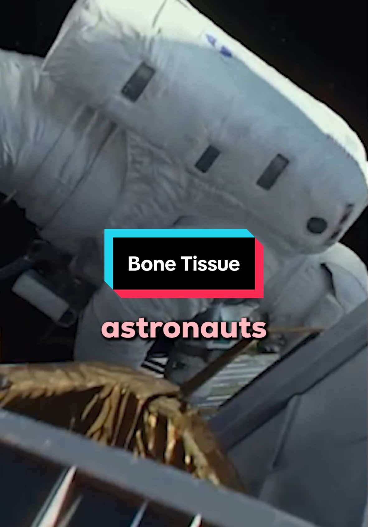 Bone Tissue- Use it or Lose it? #bone #anatomy #wow 