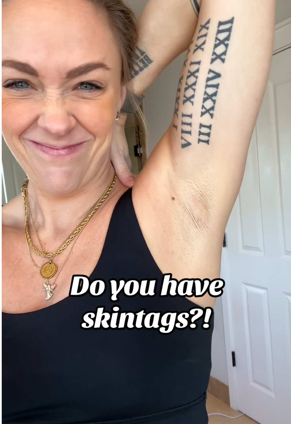 I can’t wait to see the final results!  @Claritag Advanced  #skintag #claritagpartner #claritag #athomeskincare 