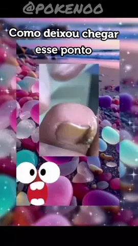 hummm #manicure #limpezadepele #ingrowntoenail #nails #unhaencravada #unhas #pedicure 