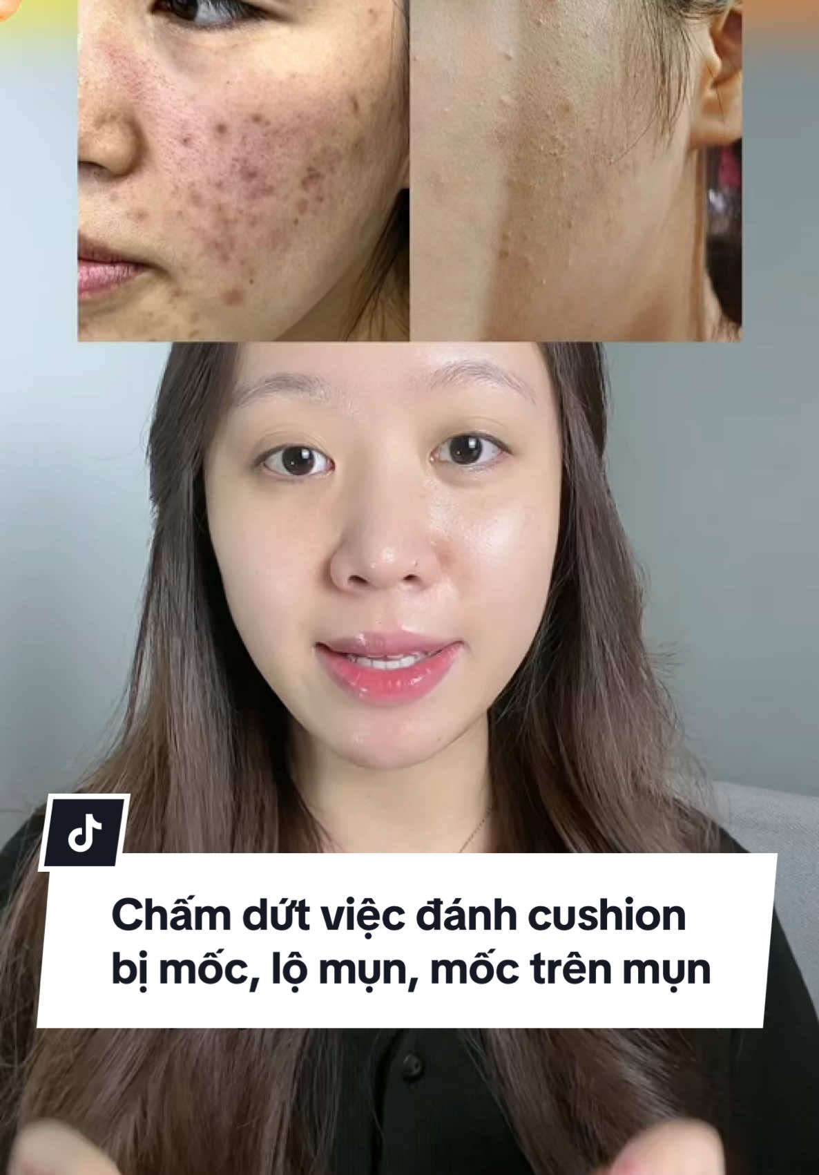 Chấm dứt việc đánh cushion bị mốc, lộ mụn, mốc trên các vết thâm mụn ✨ #janehere #janehereofficial #makeup #makeuptutorial #makeupcanhan #LearnOnTikTok #thuvienmakeup #tet2025 #khoamakeupcanhan2025 #comem 