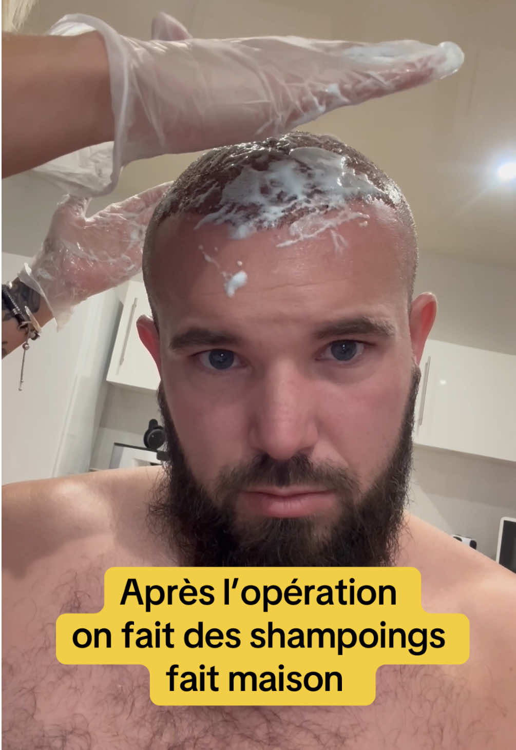 Un routine pendant 10jours #gitan #manouche #gensduvoyage #donbran #eva #gitane #blonde #greffedecheveux #cheveux #naturel #shampoing #routine #greffe #capillaire #paris #operation #soin #beaute #nouveau #nouveauté #explication #viral_video #actu #fake #fakesituation #foruyou #mousse #tendance #paname #actualité #fyp 