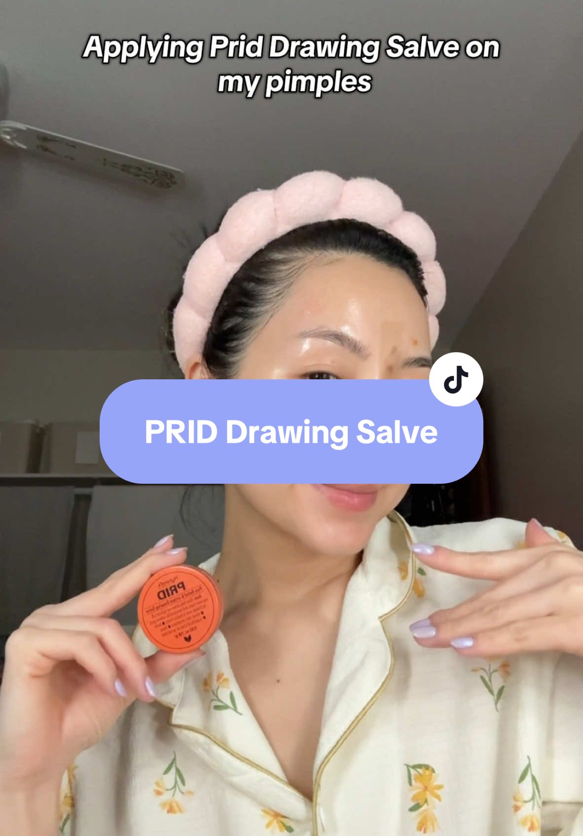 I can't believe this PRID Drawing Salve worked so quickly! #priddrawimgsalve #acnetreatment #acnecare #TikTokShopJumpstartSale #TikTokShopLoveAtFirstFind #TTSDelightNow 