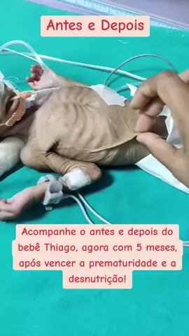 Antes e depois! #partonormal #maternidade #rn #prematuridade 