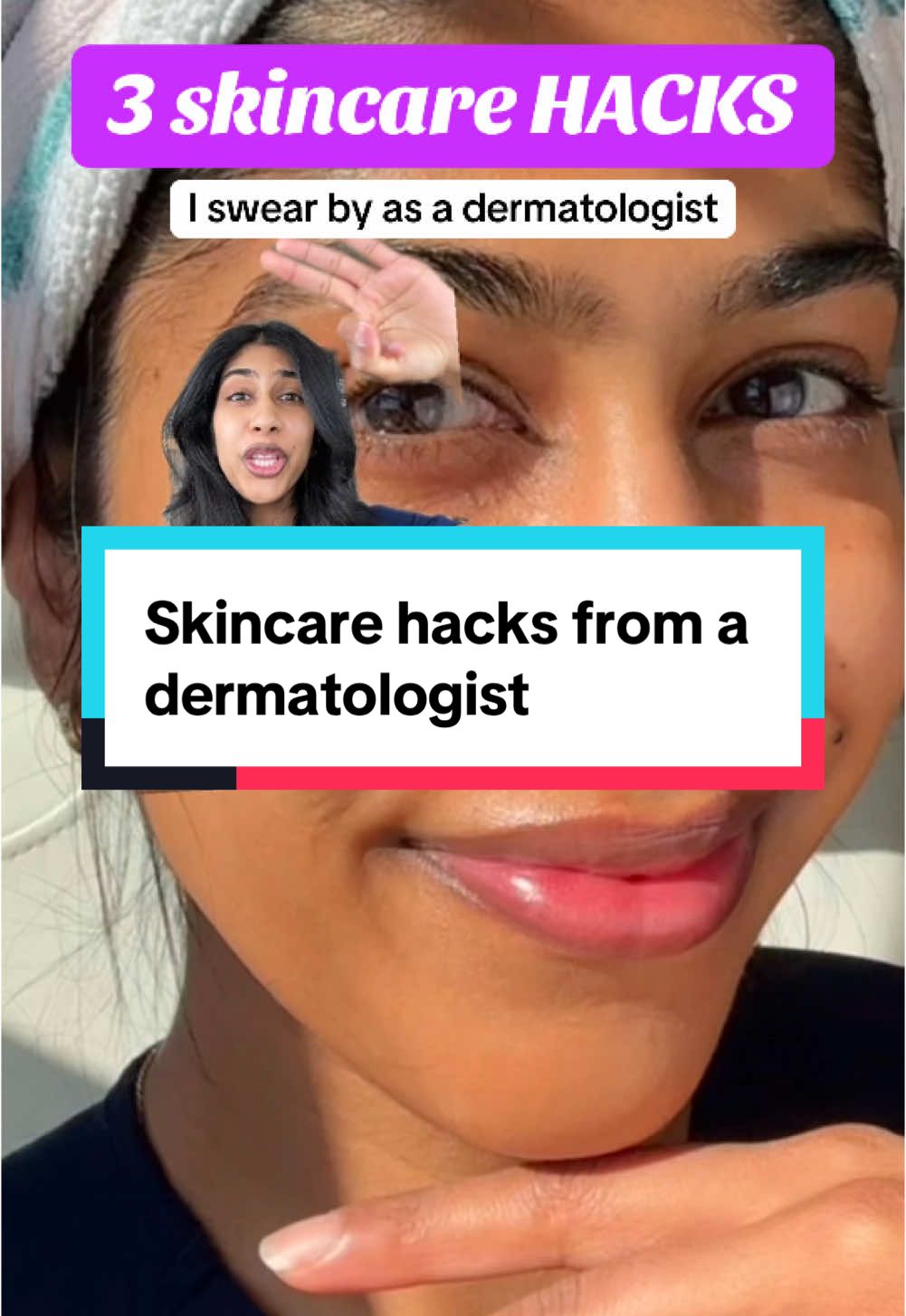 Skincare hacks I won’t gatekeep as a dermatologist #skincarehacks #hidradenitissuppurativa #fyp 