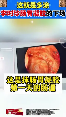 Adakah anda tertekan kerana gaya hidup yang sibuk dan tabiat pemakanan yang tidak teratur, yang membawa kepada masalah penghadaman yang teruk? Cuba Bio Gastrointestinal Gel kami untuk perlindungan lengkap sistem penghadaman anda dan merangsang metabolisme! Membantu mengurangkan kembung perut, senak dan banyak lagi! Jualan langsung kilang, jualan semasa berkembang pesat, lebih daripada 20,000 pelanggan telah membeli semula! 🔥 Biarkan anda tidak lagi mengalami masalah penghadaman dan membantu sistem penghadaman anda memulihkan kesihatan, pada harga terendah yang pernah ada!