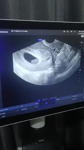 My 2 months preggy journey 😊😊😊 1st heartbeat nya 🥲🥹☺️