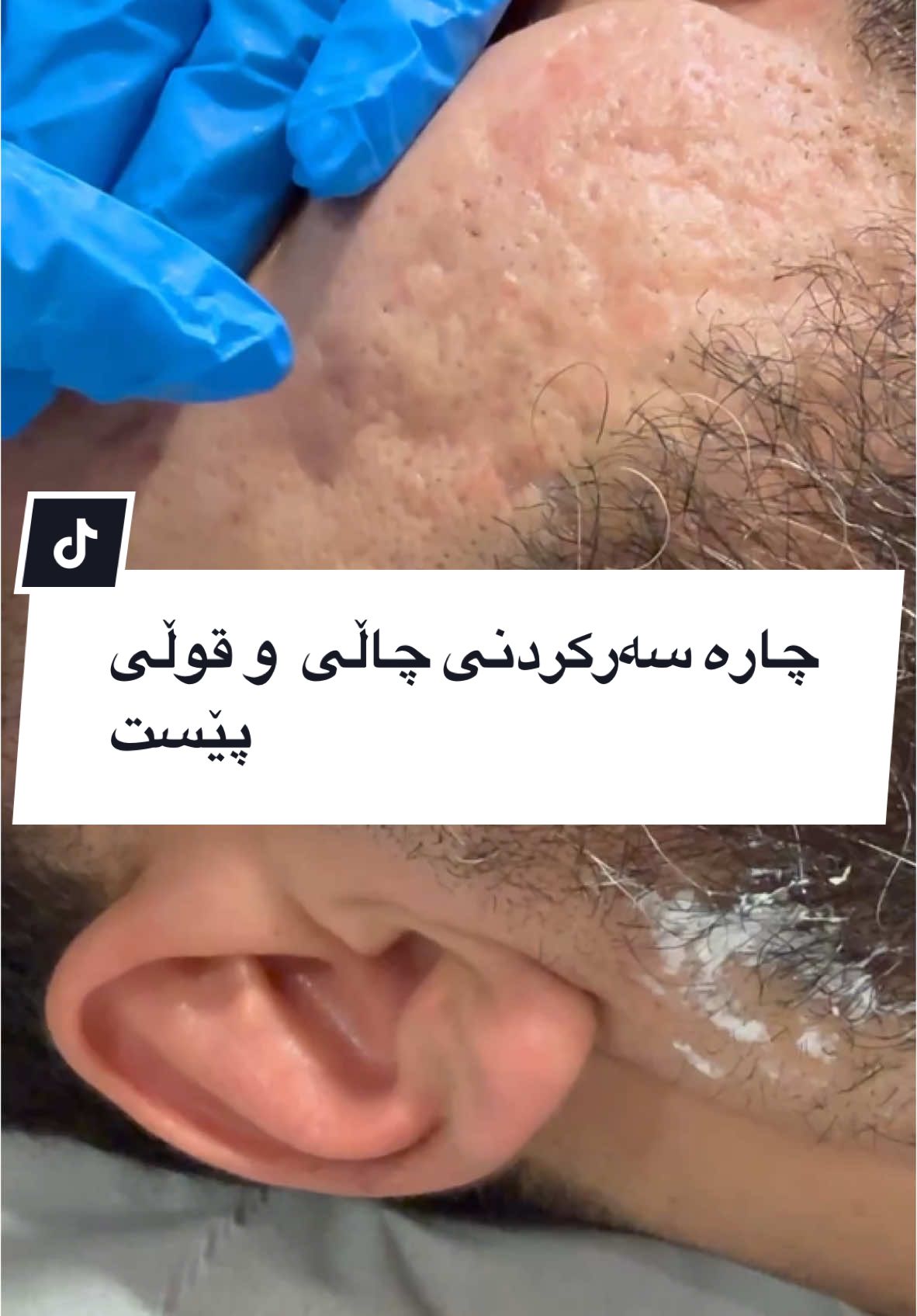 #birmingham #co2laser #tiktok_india #کردستان #سلێمانی #کرکوک__اربیل_سلیمانی_دهوك_هەڵەبجە #بلاگر #london #tiltok #manchesterunited #Scotland #viral_video #uk #loveyou #کرکوک #۵mincraft #trendingvideo #fyp #for #funnytiktok 