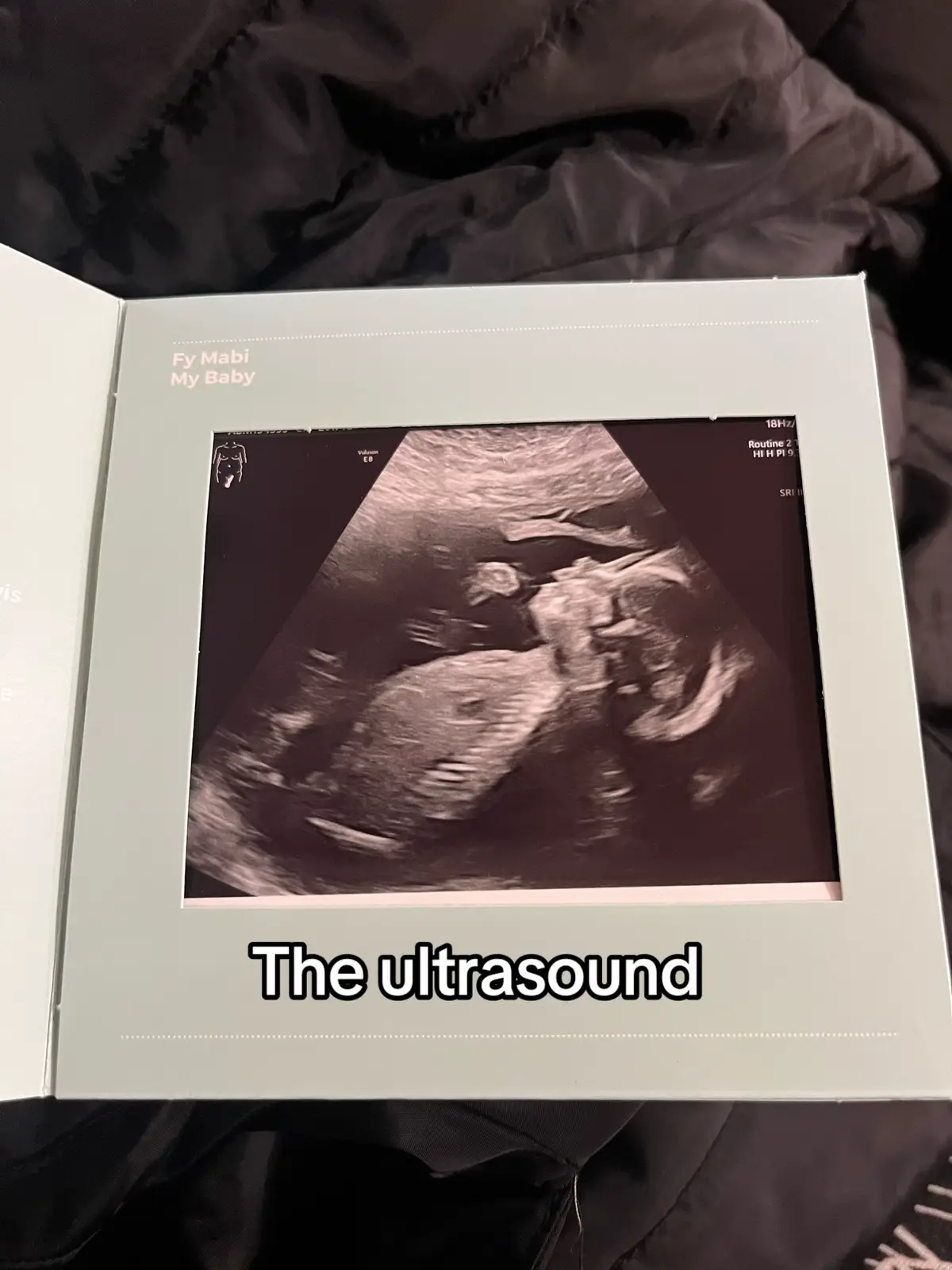 Can’t believe she’ll be 1 in 3 months time 🥺 #baby #newborn #mumlife #fyp