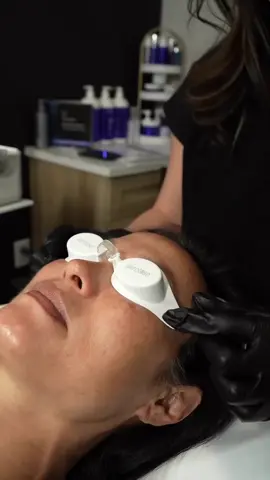 Aerolase is your all-in-one solution for skin rejuvenation and a wide range of skin concerns (+36 FDA-Cleared skin indications) 🤩🙌💙 🌟 Rejuvenates by boosting collagen and elastin for smoother, firmer skin. 🌟 Clears acne while reducing redness and inflammation. 🌟 Fades pigmentation like sunspots and melasma for an even tone. 🌟 Treats vascular concerns such as spider veins and rosacea. 🌟 Safe for all skin tones, with no downtime! #HealthyEnergyForAllSkin 📸: @kozasclinic For more information, send us a DM 📩 or visit www.aerolase.com 💻