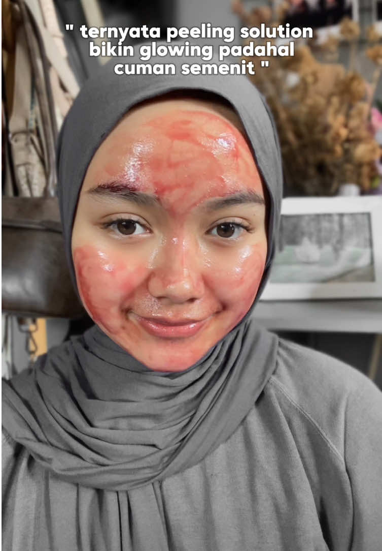 hasilnya kaya treatment di clinic kecantikan, auto glowing kinclong 🥵🫶🏻 tp kuncinya konsisten ya syg 🥰✨ #peelingsolution #g2gpeelingsolution #fyp #trending #xbcyza 