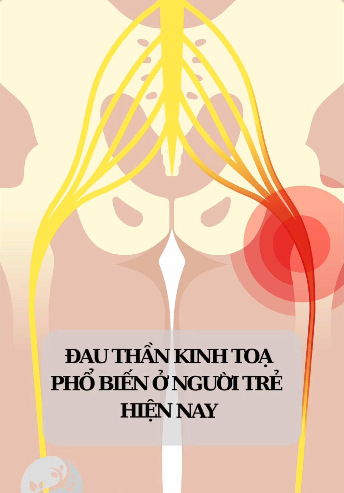 ĐAU THẦN KINH TOẠ RẤT PHỔ BIẾN GIỚI TRẺ HIỆN NAY #suckhoexuongkhop #Mocnhien #NaturalHealth #spinal #tacdongcotsong #dongy #chiropractic  #CapCut nguồn:spinalhealth