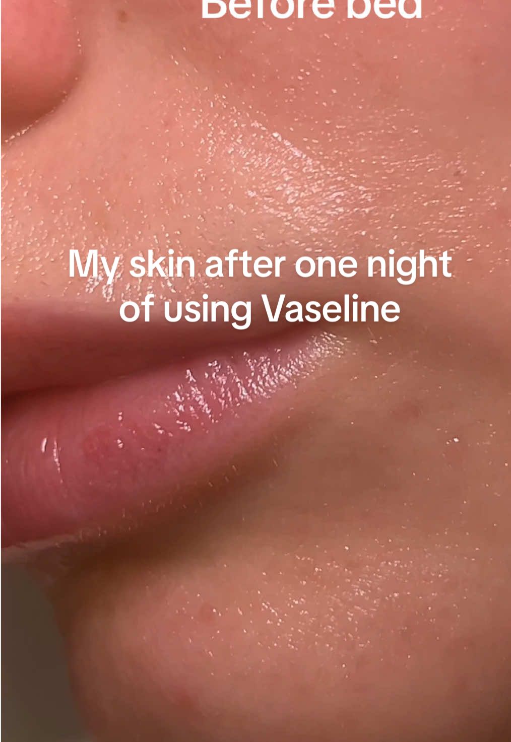 Vaseline hydrated my dry and flaky skin in just ONE night and no this is not an ad 🥲 #vaseline#skinhacks#creatorsearchinsights#dryskin#dryskintips#dryskincare#skincaretips #slugging 