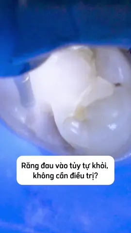 Có phải như vậy không? #nhakhoa #nhakhoavananh #saurang #hoimieng #xuhuong #fypシ #hanoi 
