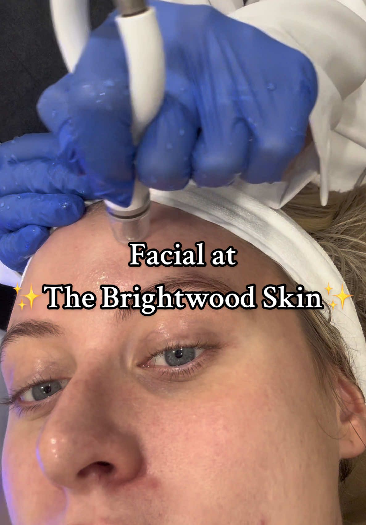 Thank you so much @The Brightwood Skin ! ✨ most amazing diamond glow facial #aesthetics #facial #skincare 