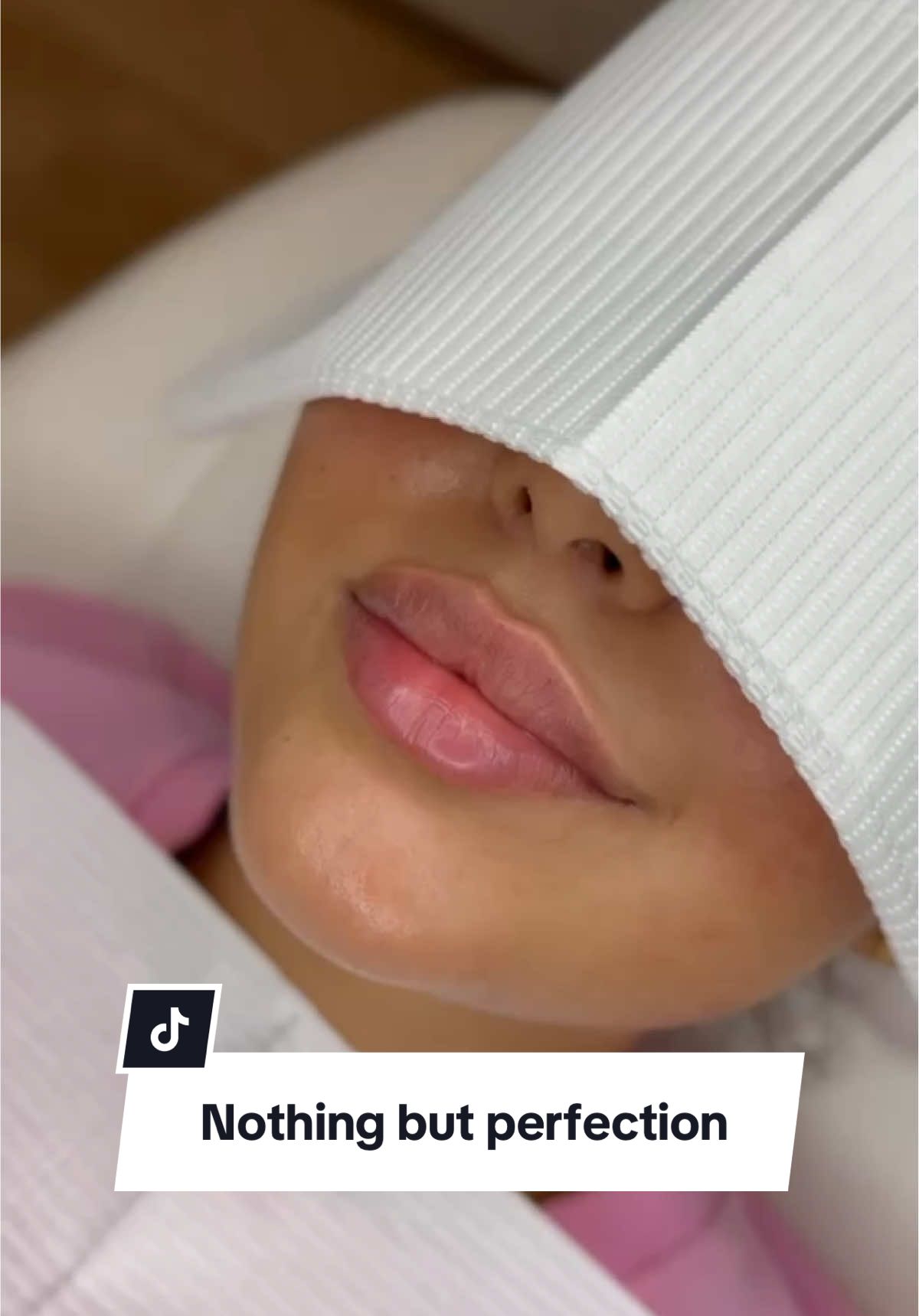 A masterpiece…🤌🏽👄 #lipfiller #drsamana 