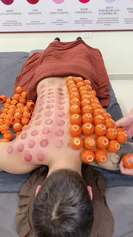 [ASMR] 拔罐- Cupping Therapy With 100 mini Cups  Do you want to hear this sound? #cuppingtherapy #asmr #trilieuhaiphong #xuhuong #Giachoi #massage 