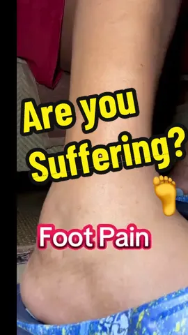 #creatorsearchinsights Do you have foot pain, swelling, fatigue, and your heel & ankles too. This Sun Patch will help ease those issues, the patch warms up, you can wear it for 4 to 6 hours! #footpain #heelpain #foot #footpainrelief 