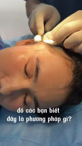 có bạn nào biết đây là phương pháp gì ko ạ!