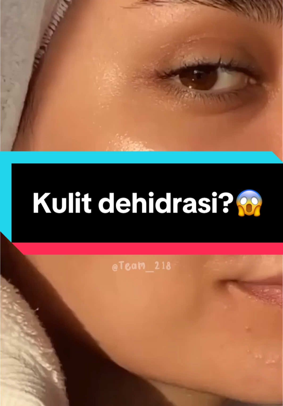 Kulit berminyak sama dengan kulit dehidrasi?🤔👀 #skinbarrier #skincareroutine #drwskincare #fyp #viral 