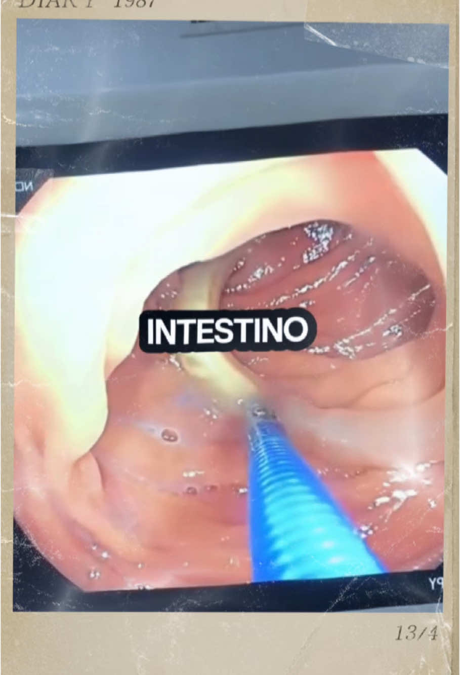 #vermes #bacteria #parasitas #ameba #sistozoma #lombriga #intestino #laranja #bagaçodalaranja #perigoso #perigo 