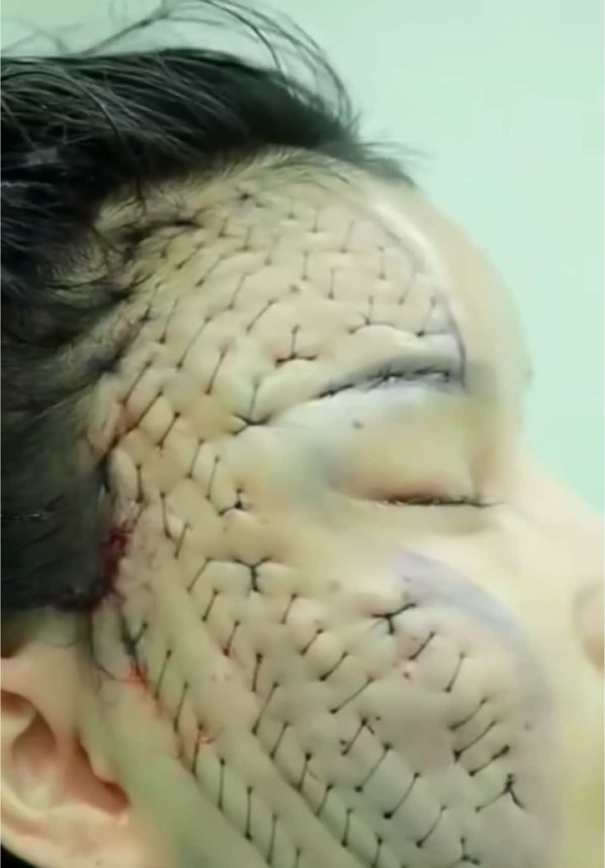 Did you know that plastic surgery in South Korea is so extreme that some patients no longer resemble their ID photos? Clinics even issue special certificates to help them pass passport control ❗️‼️