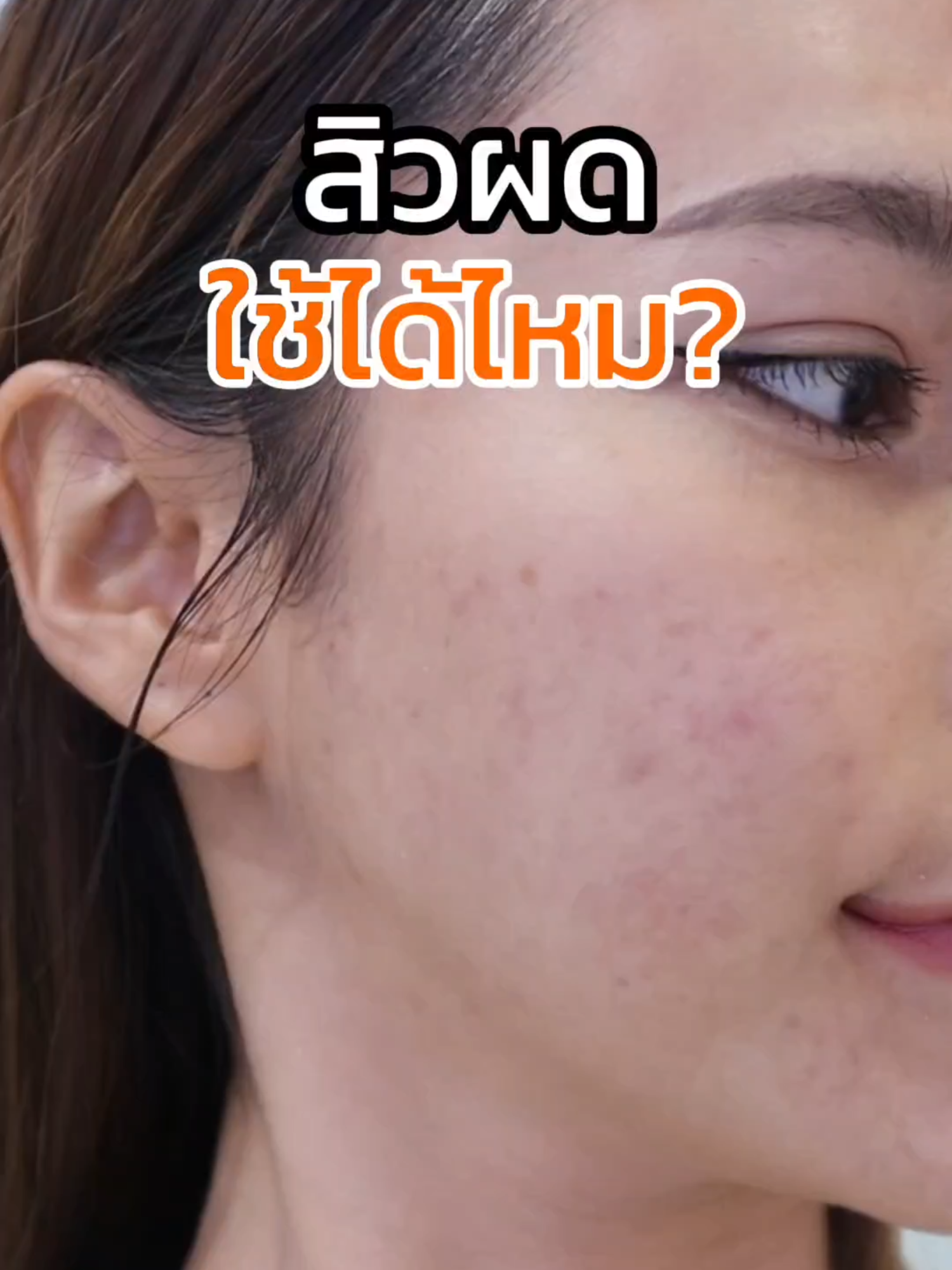 สิวผดใช้ได้ไหม? #ส้มใส #สกินแคร์ #สิว #โปรโมชั่น #เป็นสิวต้องส้มใส #ป้ายยาtiktok #ใช้ดีบอกต่อ #ส้มใสของแท้100💯🥰🧡🍊 #ส้มใสของแท้มีเลขล็อต #ส้มใสของแท้ #ฝุ่นpm25 #สิวผด