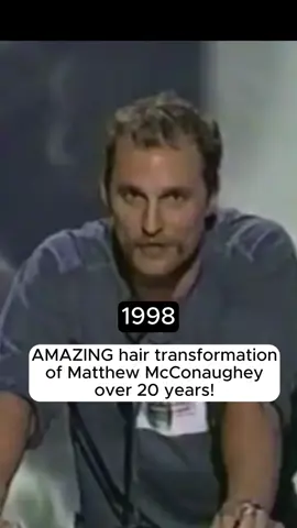 Matthew McConaughey's hair transformation is epic 🔥🔥🔥 #hairtok #hairtransformation #hairtransplantturkey #hairtransplantation #hairtransplant #hairtransplantsurgery