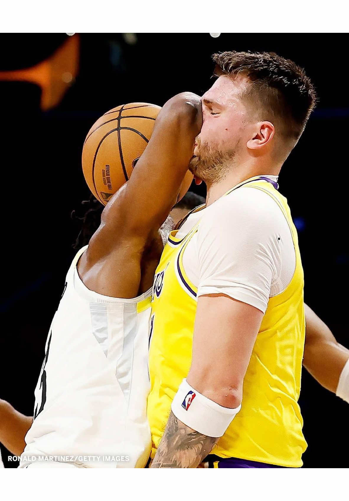 Luka Doncic took a hard elbow to the face from Isaiah Collier last night 😳  #NBA #Lakers #LukaDoncic #ForYouPage #ForYou #FYP #FY