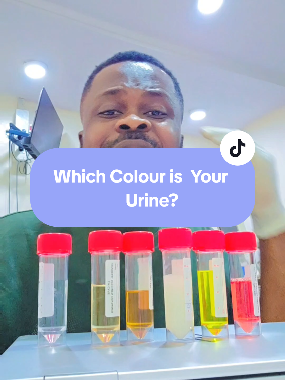 what is a normal Urine Colour?