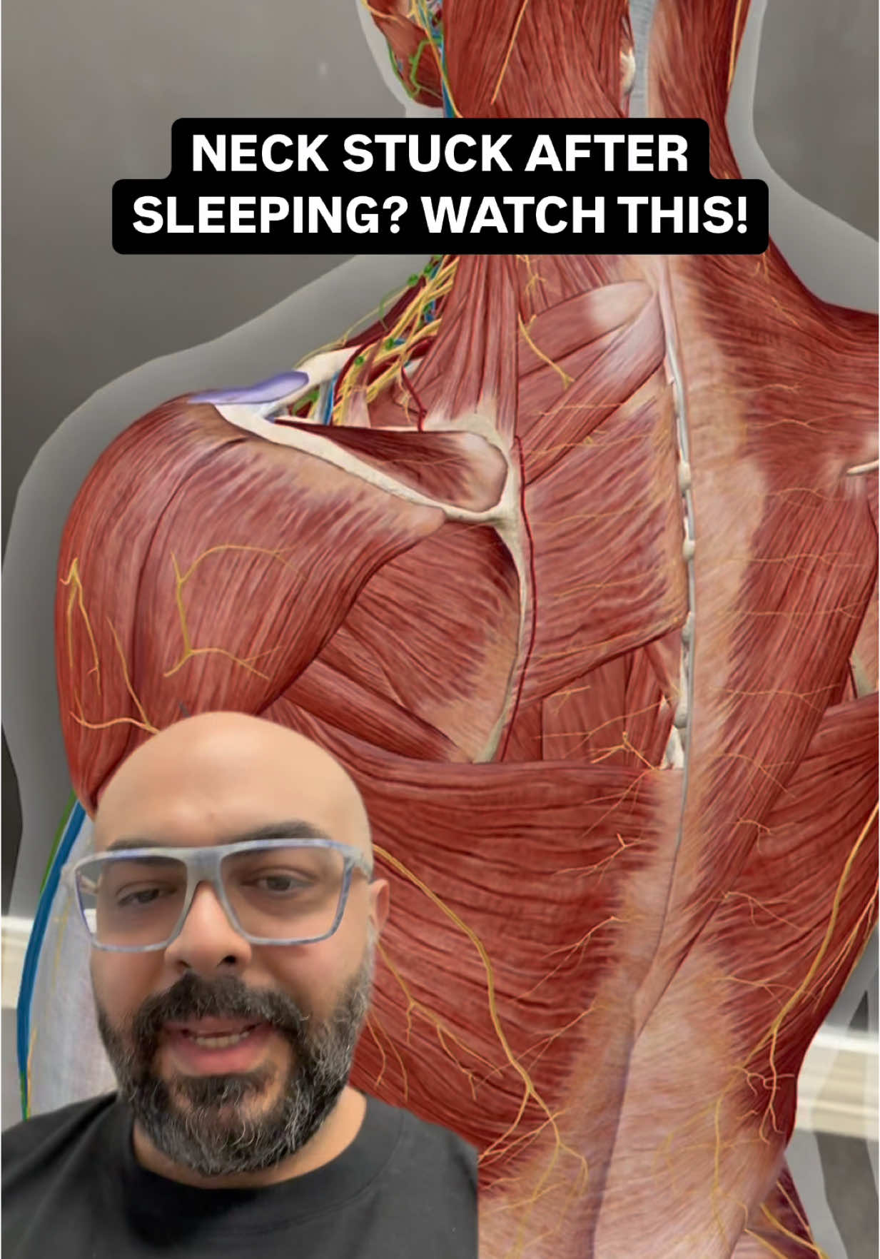 Slept Weird, Now You Can’t Move? Welcome to ‘Slept-Wrong Syndrome’ 😵‍💫💀 You crashed on the couch, head twisted in a weird position, and now… your neck is completely stuck. You try to turn your head, but pain shoots from the back of your skull, down your neck, into your shoulder blade, and even into your upper ribs. It feels serious, but in most cases, it’s actually just a muscle spasm—not a major injury. 🛑 Blame Your Sleeping Position! When your head stays locked in a bad position for too long—especially if it’s tilted or rotated—certain muscles get overstretched while others become tight and angry. The biggest culprits? The splenius capitis & splenius cervicis. These muscles stabilize your head and control neck movement, but when they’re held in an awkward position, they go into spasm to protect themselves. 🔗 But It Doesn’t Stop There! This muscle spasm can irritate the dorsal scapular nerve, which runs down your neck and into your shoulder blade. That’s why it feels like a deep ache or even like there’s a “hole” between your spine and scapula. Plus, your neck joints (facet joints) can get jammed up, making it nearly impossible to turn your head without sharp pain. ⚡ Congratulations, You Have ‘Slept-Wrong Syndrome’ (Totally Made That Up, But You Get It 🤣) The good news? This is usually a quick fix! What Can You Do at Home? If this just happened and the pain is really acute, be careful—aggressive stretching or digging into the knot can actually make it worse. Instead, try: ✅ Heat Therapy – Apply a warm compress or heating pad for 10-15 minutes to relax the muscles. ✅ Gentle Neck Movements – Slowly nod yes/no and do small, pain-free circles. Don’t force movement! ✅ Massage the Opposite Side – Sometimes, releasing the opposite side of your neck helps the painful side relax. ✅ Use a Supportive Pillow – Keep your neck neutral while resting to avoid aggravating the spasm. ✅ Magnesium or Epsom Salt Bath – Helps relax tight muscles and calm the nervous system. 🚫 What NOT to Do: ❌ Don’t forcefully stretch it—it might make the spasm worse. ❌ Avoid cracking or twisting your neck aggressively. ❌ Don’t sleep in a bad position again tonight—prop yourself up with good support! When You Need Professional Help If the pain is severe, not improving, or keeps coming back, it likely needs a hands-on fix. In the clinic, I manually release the tight muscles, adjust the stuck joints, and make sure your nerves are gliding freely. Most patients feel major relief within a session or two! 🔥 Ever wake up like this? Drop a comment below! ⬇️