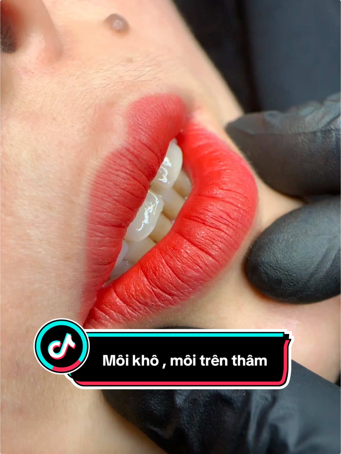 Tạm biệt môi khô, thâm xỉn ! Giờ đây môi căng mọng, lên màu đỏ cam chuẩn đẹp, không sưng, không đau, không cần nghỉ    dưỡng#minhtuacademy #phunxamthammy #xuhuong #royallips #treanding #phunmoibongdam #pmu #lamdep 