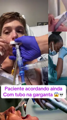 Paciente intubado 💀😱 #hospital #intubacao #morte #medico #medicina #pandemia #vida #covid #covid19 