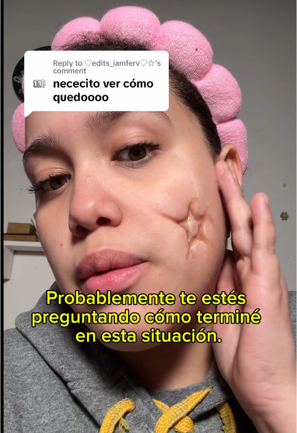 Replying to @♡edits_iamferv♡☆ SKIN CARE GONE WRONG pt. 2 #fyp #skincare #beautyhacks #cuidadodepiel #mascarilla #asmr #beautytips