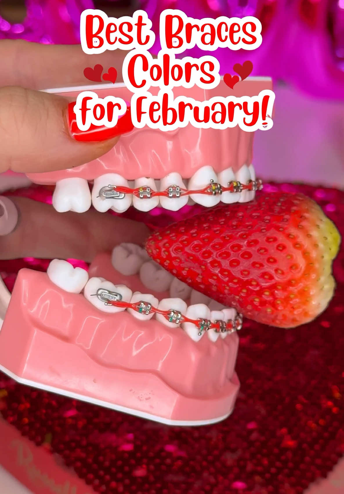 What color are you picking for VALENTINE'S DAY?! #braces #bracescolors #ValentinesDay #valentine #fyp 