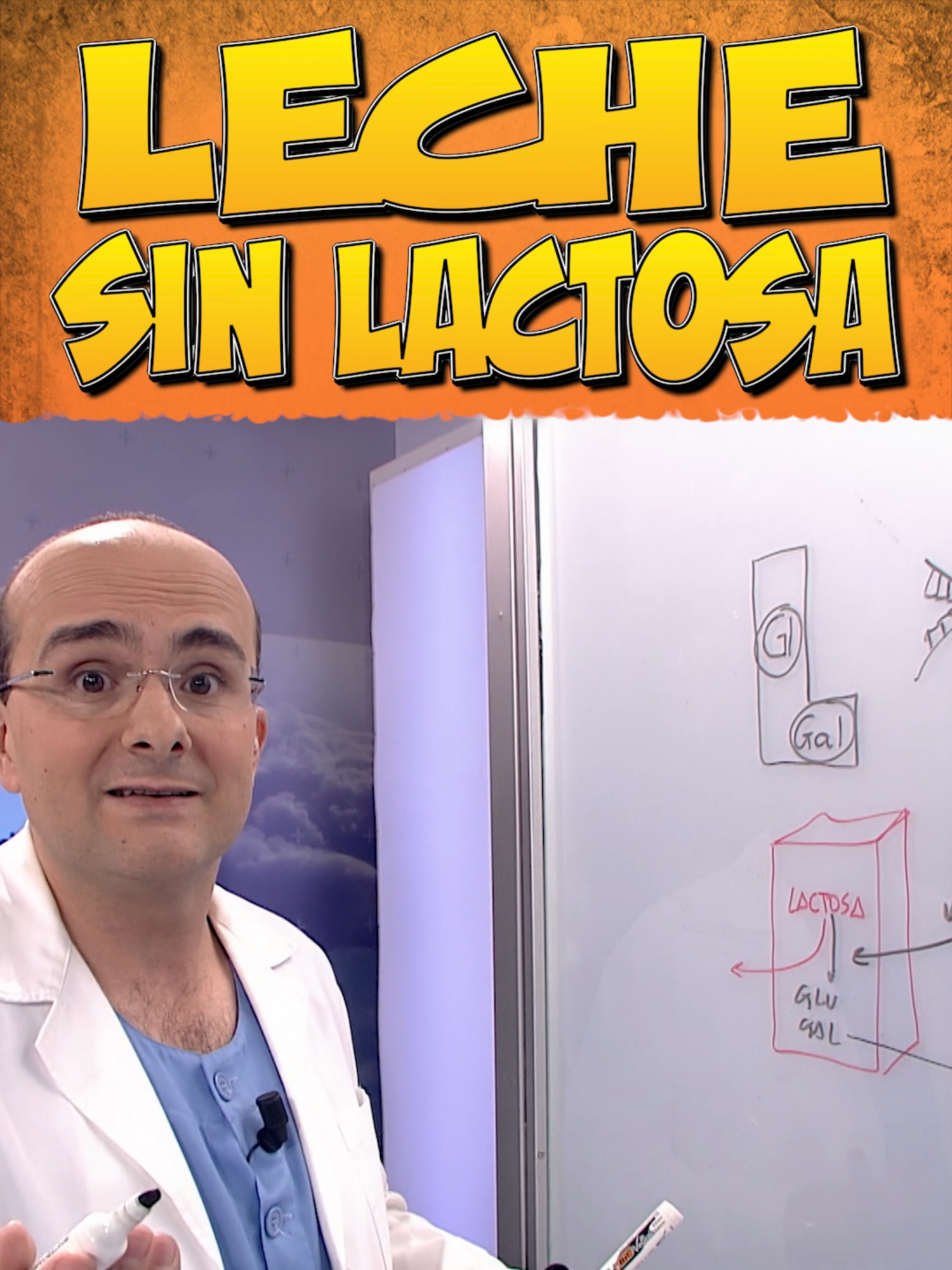 LECHE SIN LACTOSA La leche contiene un azúcar, un disacárido, la lactosa que es la suma de dos azúcares sencillos: la glucosa y la galactosa. Muchas personas no toleran la leche porque no son capaces de absorber esa lactosa. La solución está en la leche sin lactosa. Pero ¿es que la leche sin lactosa es una leche a la que se le quita la lactosa? En el vídeo entenderá qué es la leche sin lactosa y qué se hace con ella para que las personas con intolerancia a la lactosa la puedan tomar. #leche #lactosa #glucosa #galactosa #intestinodelgado #lactasa #malabsorción #diarrea #gases #intestinogrueso #lechesinlactosa