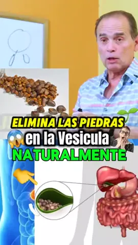 😱 Elimina las piedras de la vesícula NATURALMENTE ✅ #franksuarez #dieta #salud #jugosverdes #paratiiiiiiiiiiiiiiiiiiiiiiiiiiiiiii #fyp #reels #viral_video #tendencia #humor #2025 #contenido#franksuarez #dieta #salud #jugosverdes #paratiiiiiiiiiiiiiiiiiiiiiiiiiiiiiii #fyp #reels #viral_video #tendencia #humor #2025 #contenido 