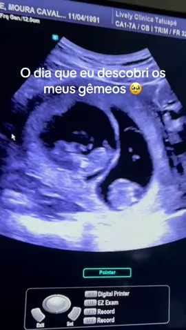 Meu maior presente 🎁  Meu casal de gêmeos  #ultrassomgestacional #gemeos 