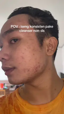 Kalo ga karna cleanser si nonot yang non-sls mungkin aku ga bisa kayak gini🙂‍↔️ #fypシ゚ #acnefighter #acneskin #skincaretips #skincareroutine #skincareviral #skintok #theoriginote #facewash 