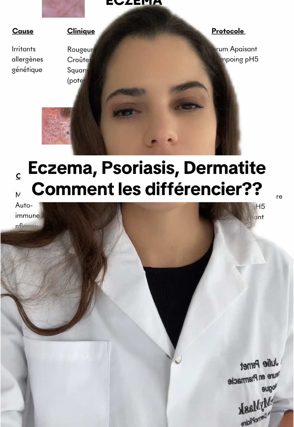 ⚠️ #CuirCheveluIrrité ou #squames ? 🤔 Tu hésites entre #Dermatite, #Eczéma ou #Psoriasis ? 🔍 Cette vidéo t’aide à mieux comprendre ! Dis-moi en commentaire ce que tu penses avoir 👇💬 #SoinsNaturels #ScalpCare #Trichologie #PeauSensible #Démangeaisons #CuirCheveluSain #HairCare #MakeMyMask #DrPharmaTrichologue