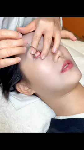 eye cleaning asmr #foryoupage❤️❤️ #fyp #treatment #asmr 