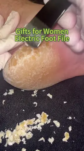 Electric Foot Callus Remover!!Salon-Quality - Pedicure at home#Beauty #foot #footfiles #footcallusremover #electricfootcallusremover #electricfootfie #callus #foryou #giftideas #giftsforwomen 